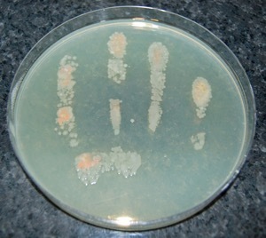 Microorganisms on the fingers of a hand washed in only warm tap water.