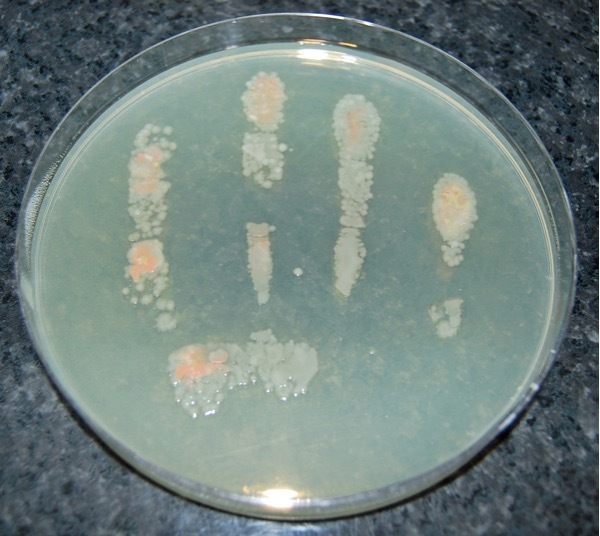 Microorganisms on the fingers of a hand washed in only tap water