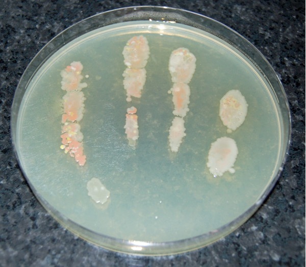 Microorganisms that start to grow in the agar from the hand's bacteria.