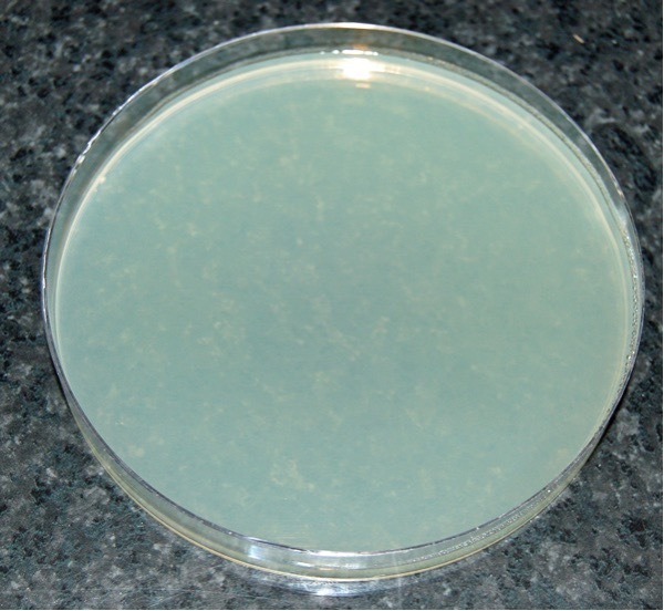 A petri dish of agar with few microorganisms.