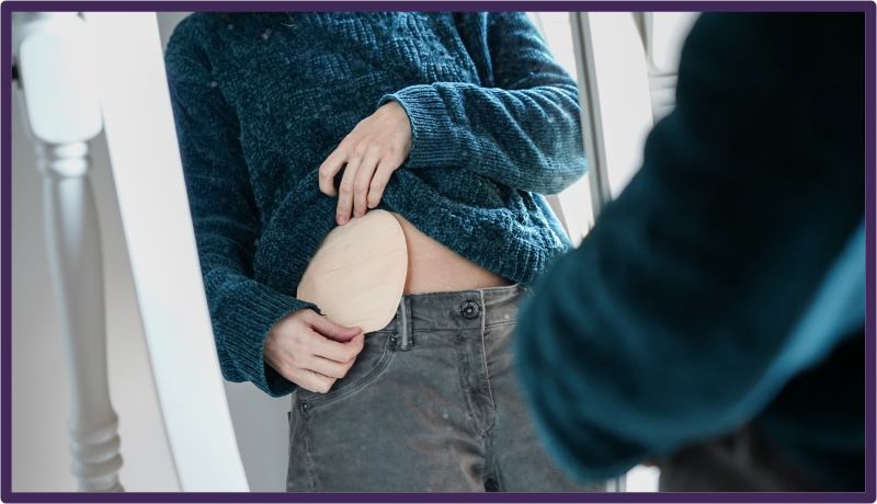 A person looking in the mirror showing their colostomy bag
